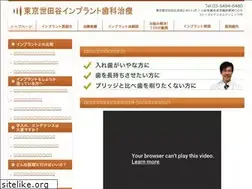 Sites similar to 1implant.jp
