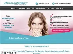 Sites similar to acceledontics.com