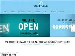 Sites similar to acebraces.ie