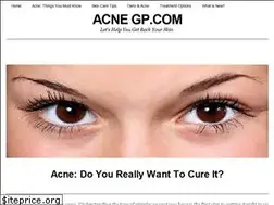 Sites similar to acne-gp.com