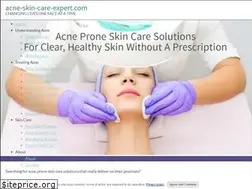 Sites similar to acne-skin-care-expert.com