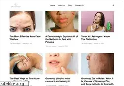 Sites similar to acne-treatment.org