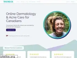Sites similar to acne.ca