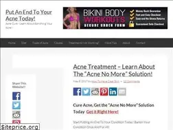 Sites similar to acne101.info