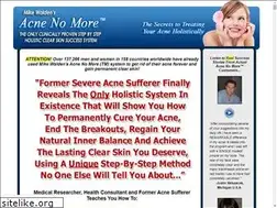Sites similar to acnenomore.com