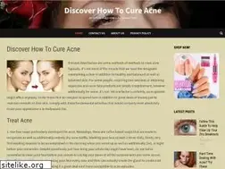 Sites similar to acnereview.biz