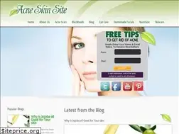 Sites similar to acneskinsite.com