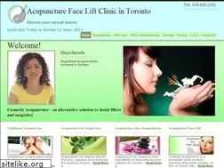 Sites similar to acufacelift-toronto.com