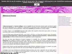 Sites similar to adenocarcinoma.it