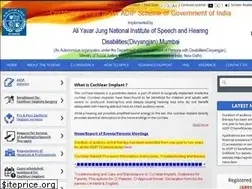 Sites similar to adipcochlearimplant.in