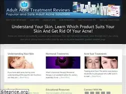 Sites similar to adultacnetreatmentreviews.com