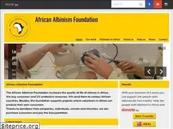 Sites similar to african-albinos.org