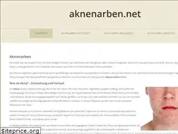 Sites similar to aknenarben.net