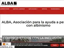 Sites similar to albinismo.es