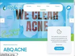 Sites similar to albuquerqueskincareandacneclinic.com