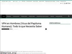 Sites similar to alivioparaelherpes.com