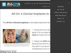 Sites similar to allon4dentalimplants.org