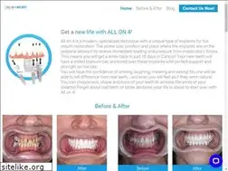 Sites similar to allon4implants.dental