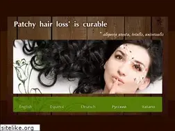 Sites similar to alopecia-areata.com