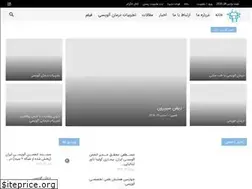 Sites similar to alopeciango.ir