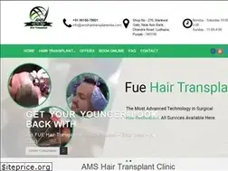 Sites similar to amshairtransplantindia.com