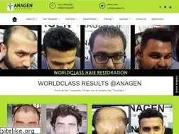 Sites similar to anagen.in