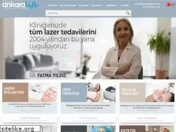 Sites similar to ankaralazer.com
