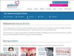 Sites similar to ankuradental.com