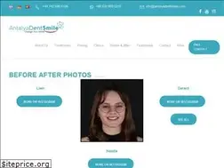 Sites similar to antalyadentsmile.com