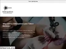 Sites similar to anticipationtattooremoval.com