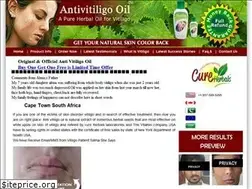 Sites similar to antivitiligooil.com