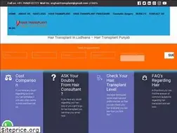 Sites similar to asghairtransplant.com