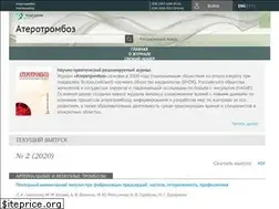 Sites similar to aterotromboz.ru