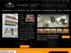 Sites similar to atlantictattooremoval.com