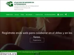 Sites similar to atlasautoinmunidad.org