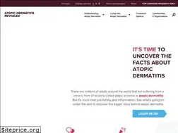 Sites similar to atopicdermatitisrevealed.ca