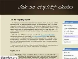 Sites similar to atopicky-ekzem.net