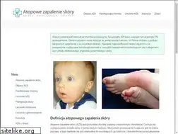 Sites similar to atopowezapalenieskory.com