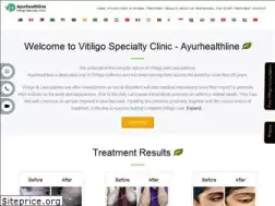 Sites similar to ayurhealthline.com