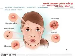 Sites similar to azacne.co