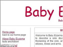 Sites similar to babyeczematreatments.com