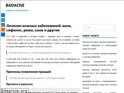 Sites similar to badacne.ru