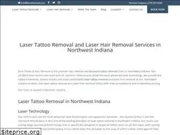 Sites similar to bareremoval.com