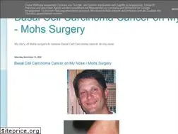 Sites similar to bccmohsnose.blogspot.com