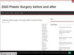 Sites similar to beforeandafterceleb.com