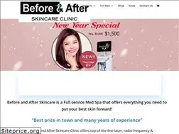 Sites similar to beforeandafterskin.com