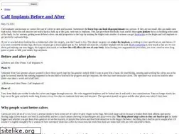 Sites similar to beforeandafterz.com