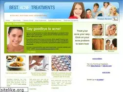 Sites similar to bestacnetreatments.org