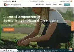 Sites similar to bestacupuncture.com