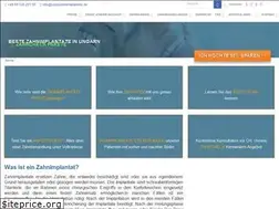 Sites similar to bestezahnimplantate.de